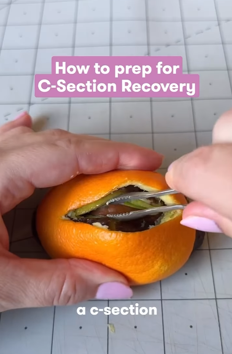 为什么你的 Instagram 起不来量？1 个真实案例告诉你社媒内容运营真相！